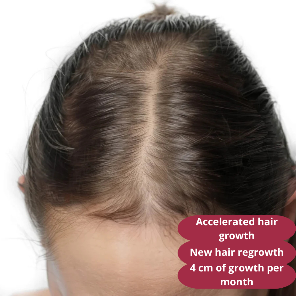 1 week result
